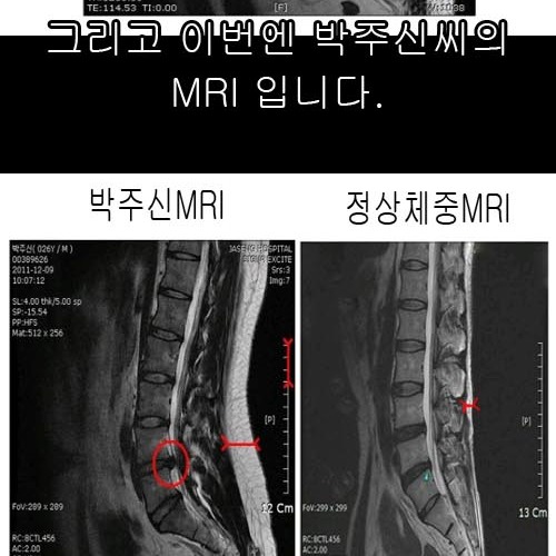 가짜:확실하지않으면 승부..