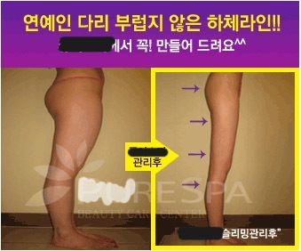 반도의 흔한 성형기술.jpg