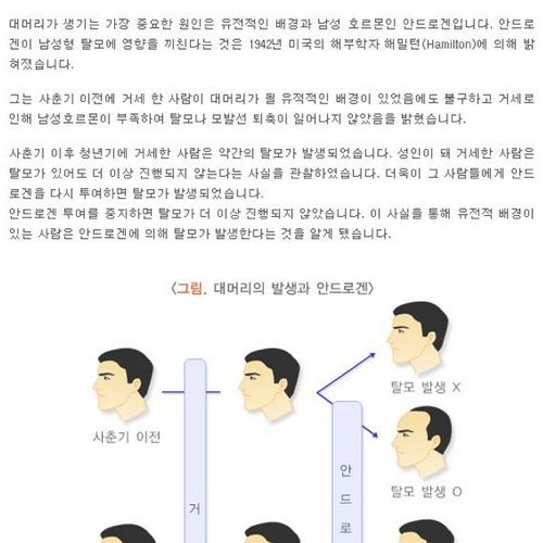 남성 대머리막는 확실한방법.jpg