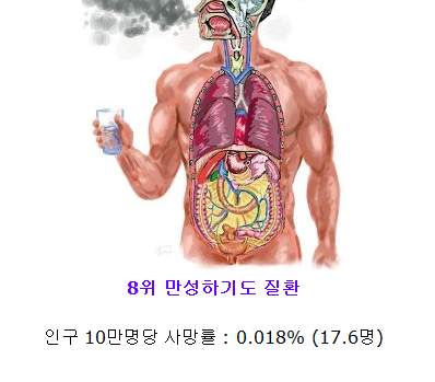 대한민국 남성 사망원인 Top10