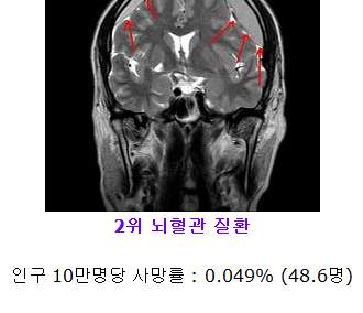 대한민국 남성 사망원인 Top10