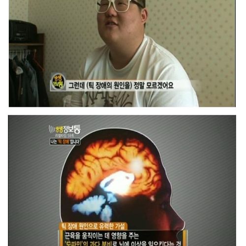 [스압]나는 틱장애입니다.jpg