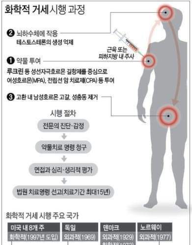 성범죄자 거세하는 나라.JPG