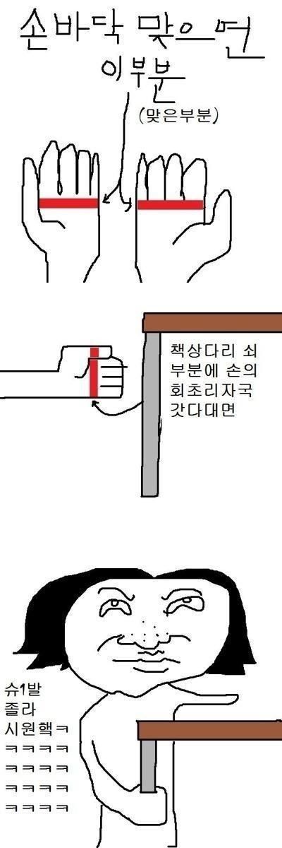 손바닥에 회초리 맞았을때