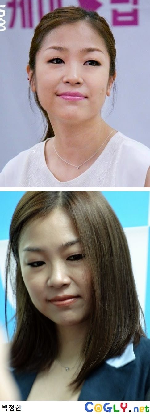 20년뒤 김연아.jpg