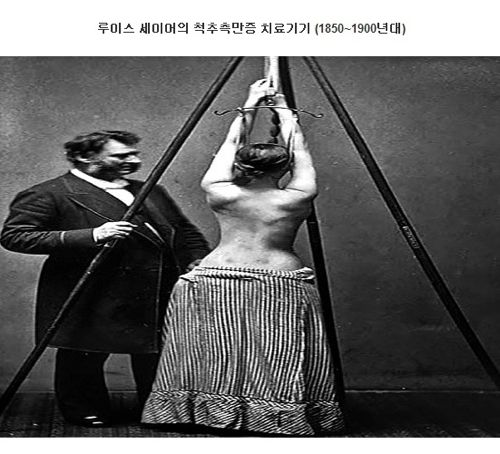 과거의 의료기구.jpg