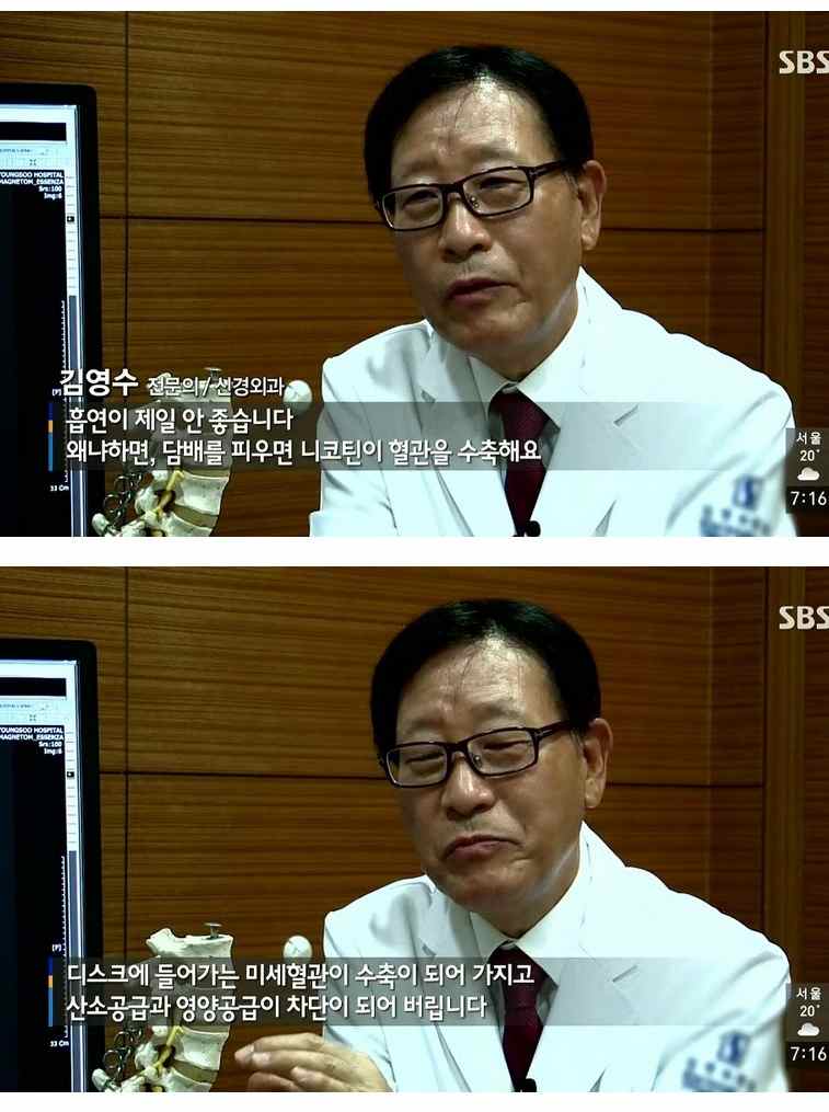 허리 디스크의 원인