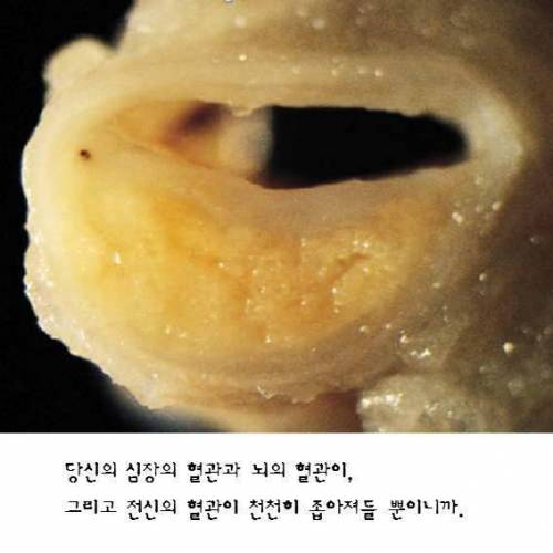 위험한 `대창구이' 의 현실