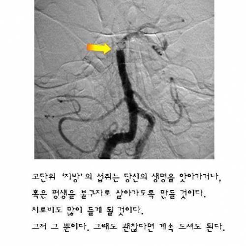 위험한 `대창구이' 의 현실