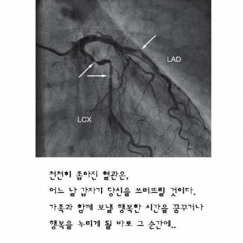 위험한 `대창구이' 의 현실