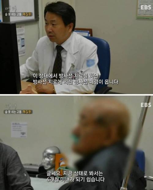 무서운 폐질환.jpg