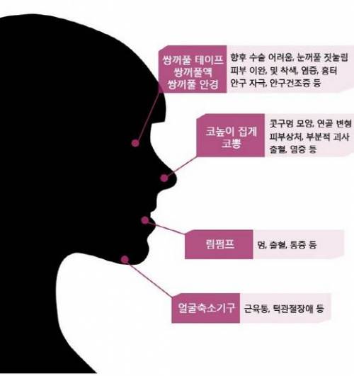 요즘 중고생들이 많이 한다는 셀프성형