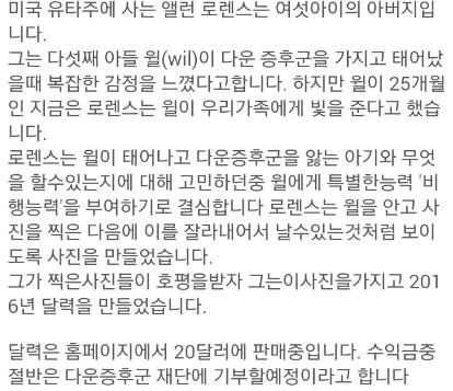 다운증후군 아기 윌의 특별한 능력