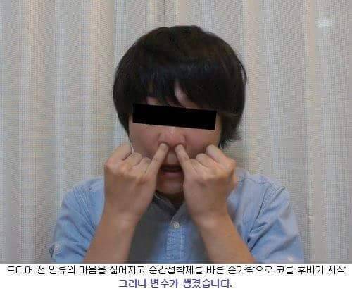 순간접착제로 콧털 뽑기.jpg