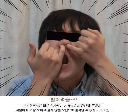 순간접착제로 콧털 뽑기.jpg