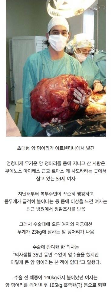 수술 한번으로 23kg 감량.jpg