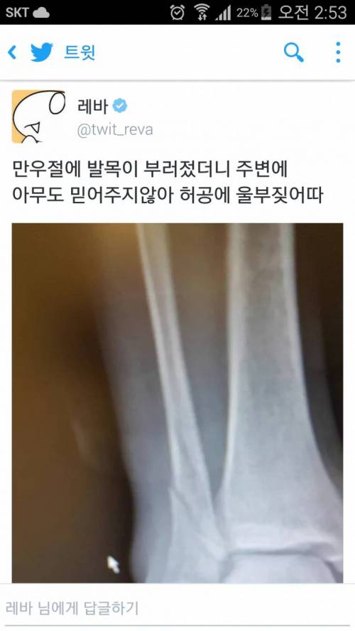 만우절에 거짓말 같이 발목이 부러진 레바