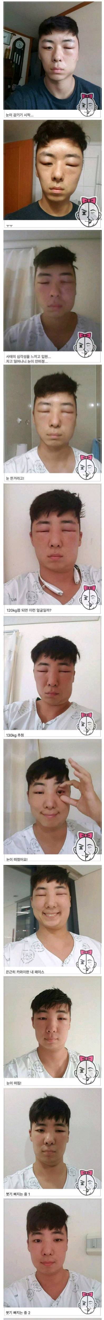 염색약 부작용...