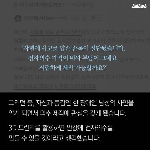 100만원짜리 손을 파는 남자