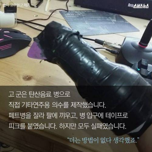 100만원짜리 손을 파는 남자