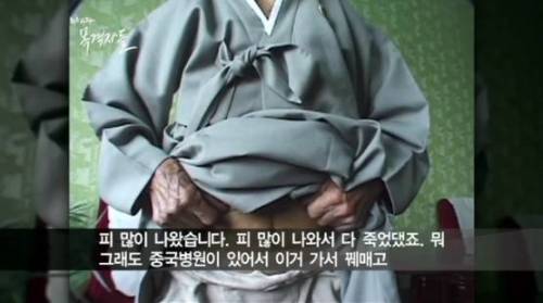 위안부 사진 속 만삭 소녀