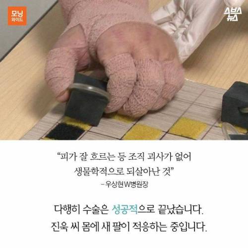 팔을 선물 받은 사나이.jpg