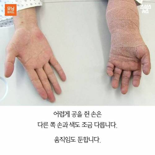 팔을 선물 받은 사나이.jpg