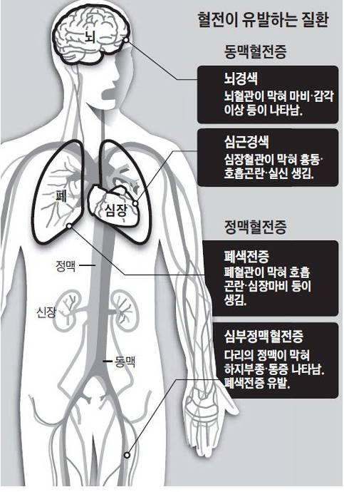 미세먼지가 위험한 진짜 이유