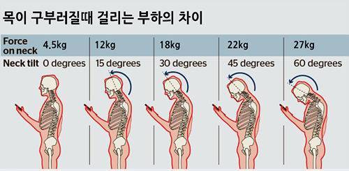 머리를 숙이는 각도에 따라 목에 걸리는 무게.jpg