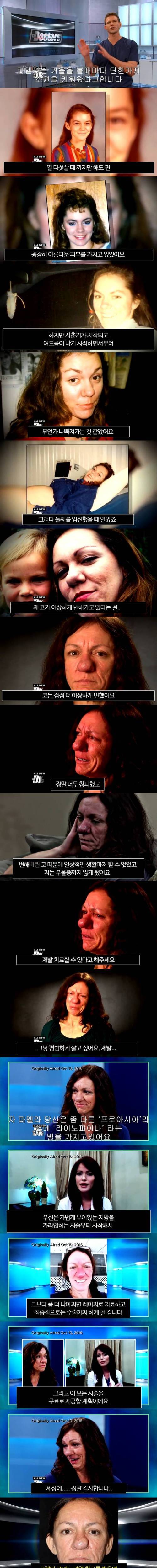 코 때문에 숨어 살던 여자.jpg