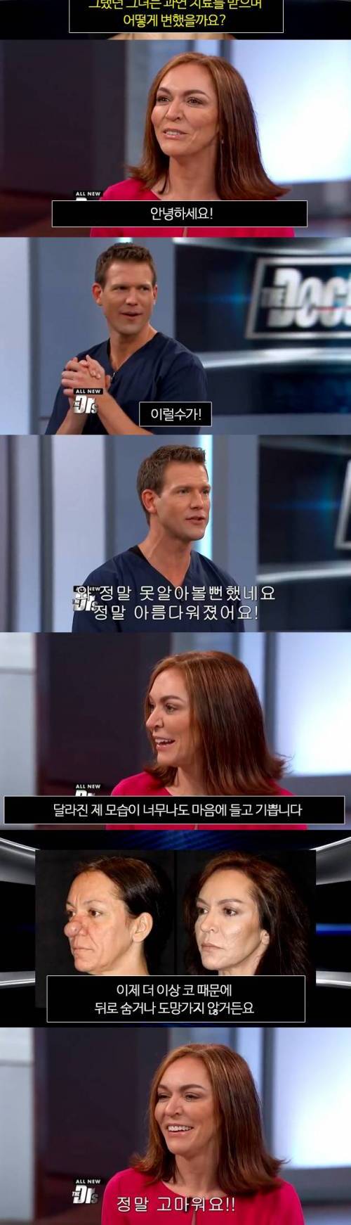 코 때문에 숨어 살던 여자.jpg