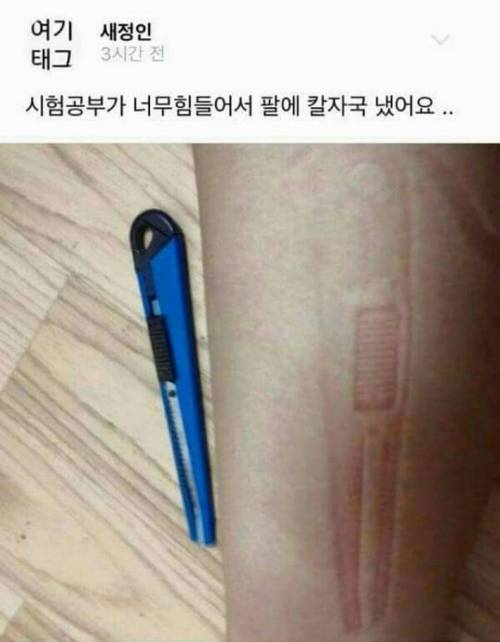 너무 힘들어서 팔에 칼자국을 냈어요.jpg