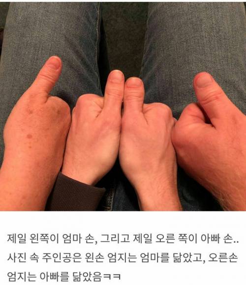 부모님한테 엄지손가락을 한쪽씩 물려 받음.jpg