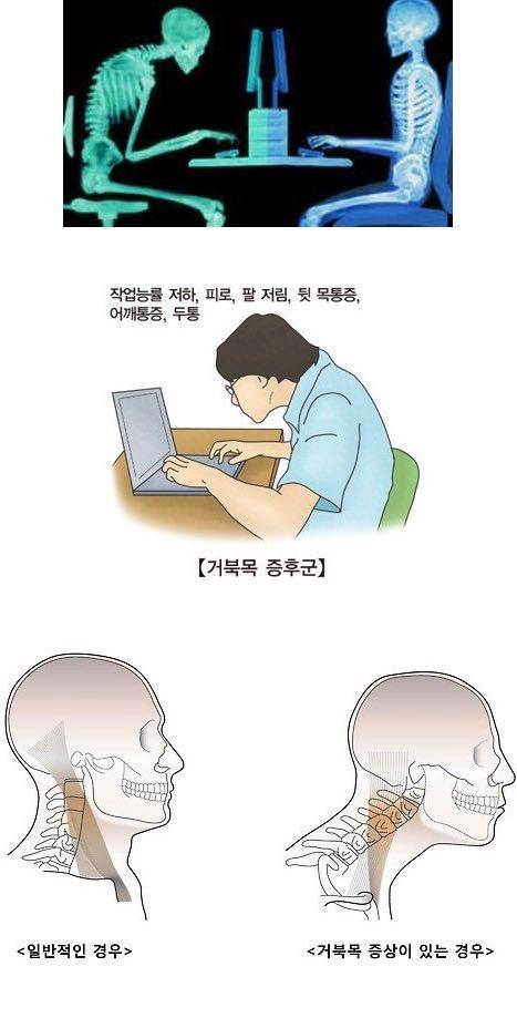 컴퓨터 앞에 앉아 있는 분들 필독.jpg