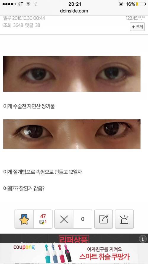 남자 눈성형 하기 전이 낫다 vs 후가 낫다.jpg