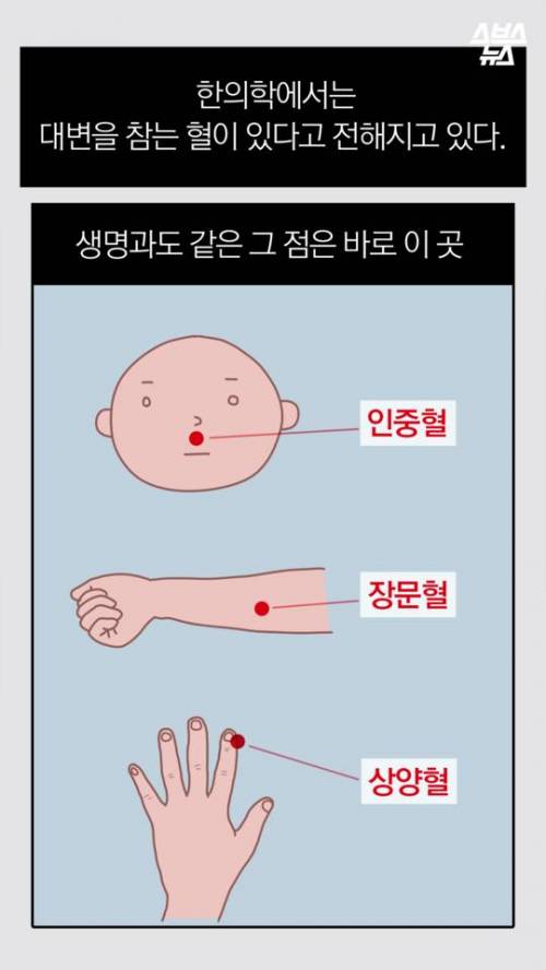 급똥 참는법.jpg