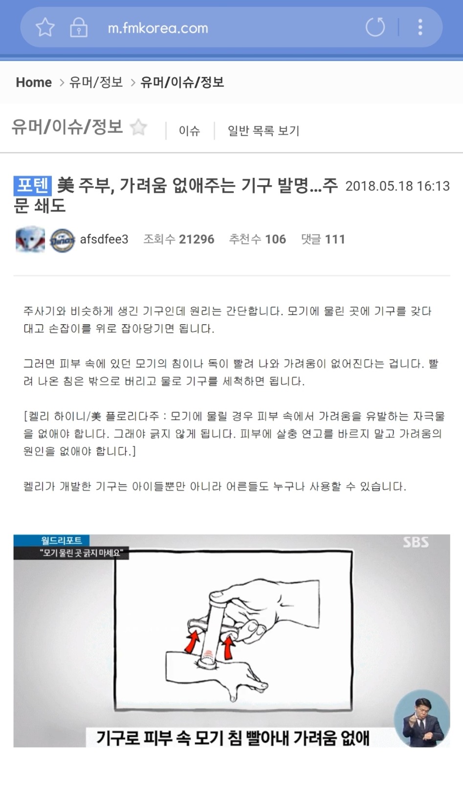 모기 물린 가려움 없애주는 기구 발명.jpg