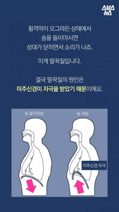 딸꾹질을 멈추려고 ~~까지 해봤어의 최강자