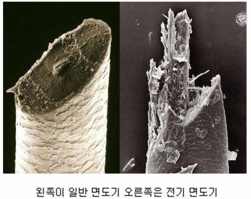 면도 후 현미경으로 본 수염 단면.jpg