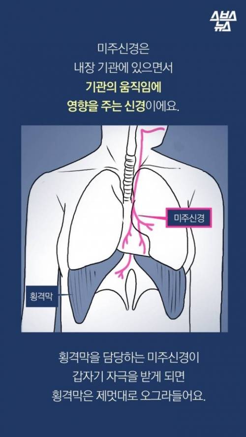 딸꾹질을 멈추려고 ~~까지 해봤어의 최강자