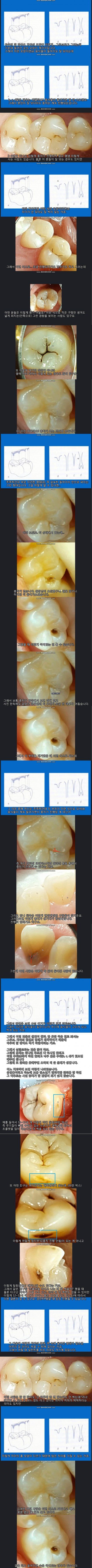 치아도 타고나는 것이다.jpg