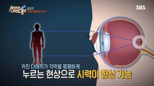 어느날 갑자기 시력이 3배 이상 좋아졌다.jpg