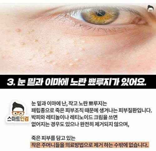 단순 여드름이 아닌 피부 트러블 4가지.jpg