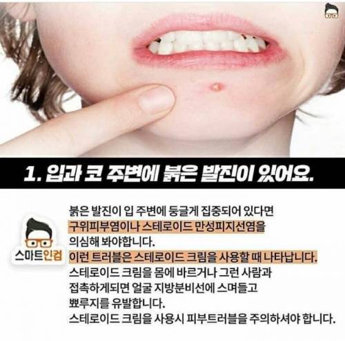 단순 여드름이 아닌 피부 트러블 4가지.jpg