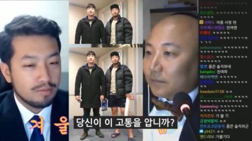 침착맨이 긴바지를 못입는 이유.jpg