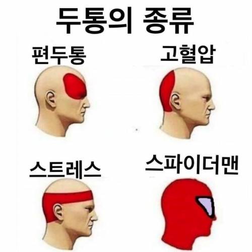 두통의 종류.jpg