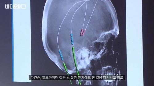 [스압] 신에 도전하는 인간 디지털 헬스케어.jpg