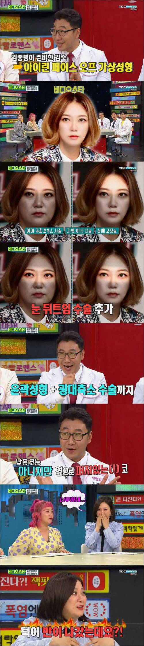 2천만원 짜리 아이린 페이스 오프 가상 성형.jpg