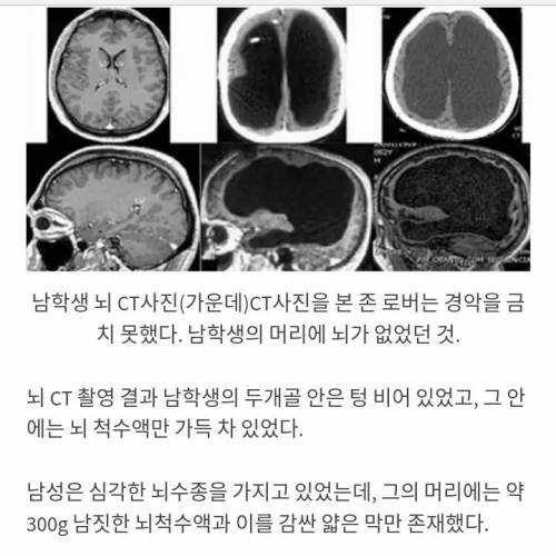 뇌가 없는 우등생.jpg