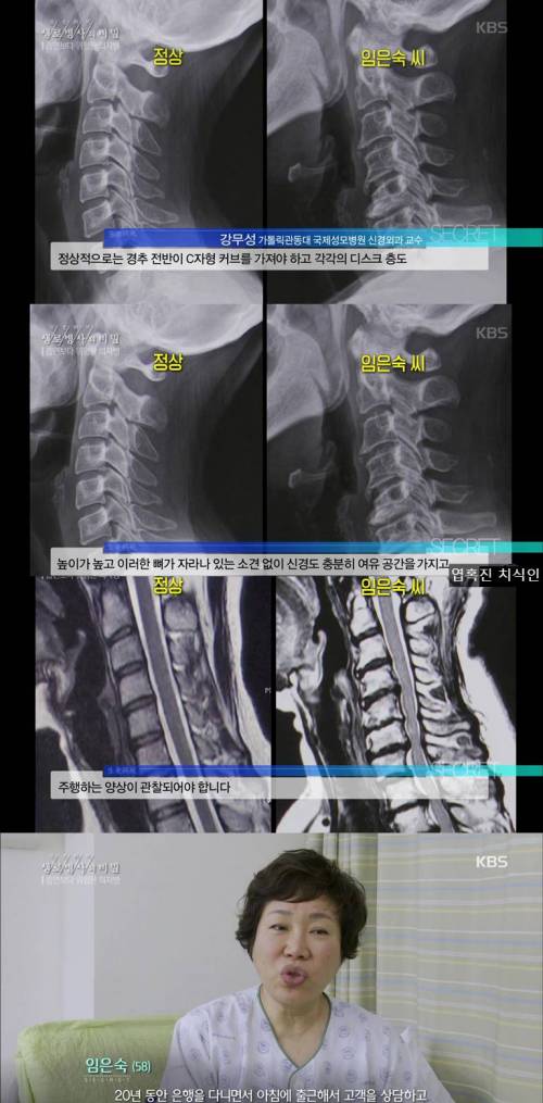 오래 앉아있는 현대인들이 피하지 못하는 질병...jpg